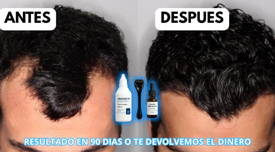 Resultados en 90 días o te devolvemos el dinero